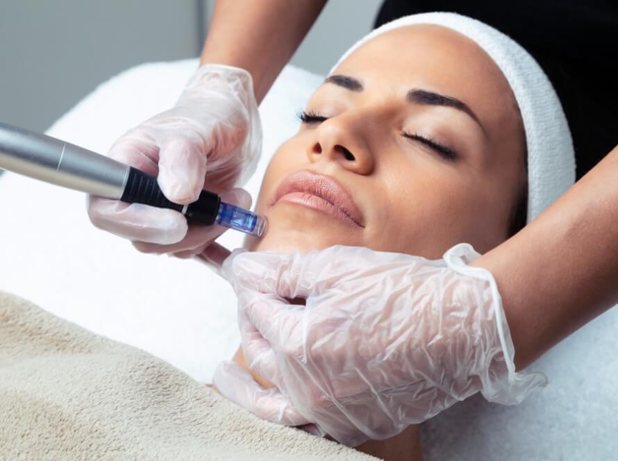 Microneedling Near Me